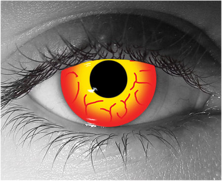 contact lenses